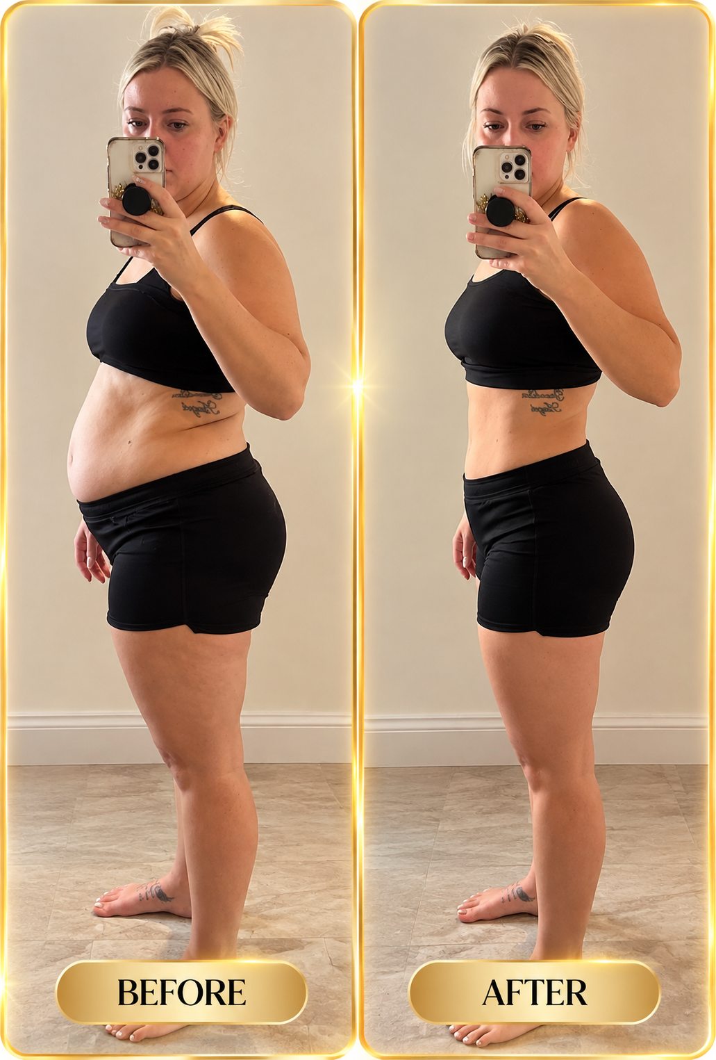 Real before and after result shown from the side with phone
