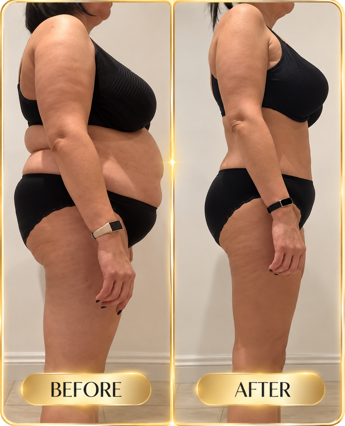 Real before and after result shown from the side
