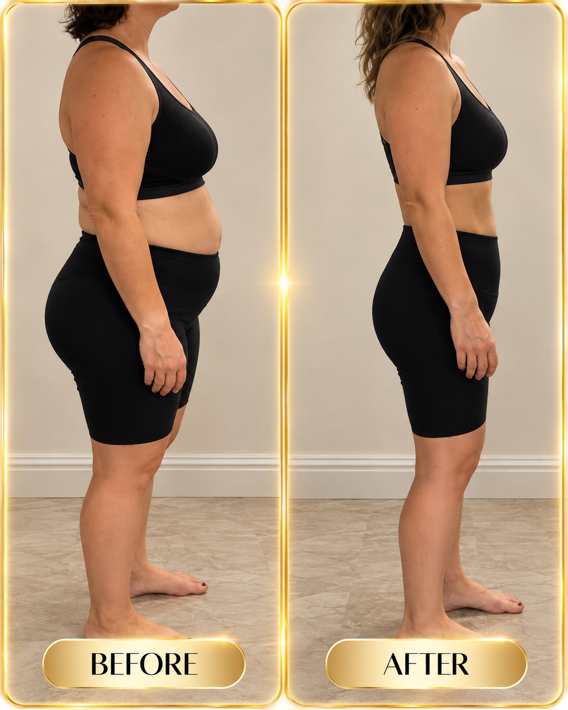 Real before and after result, side standing view
