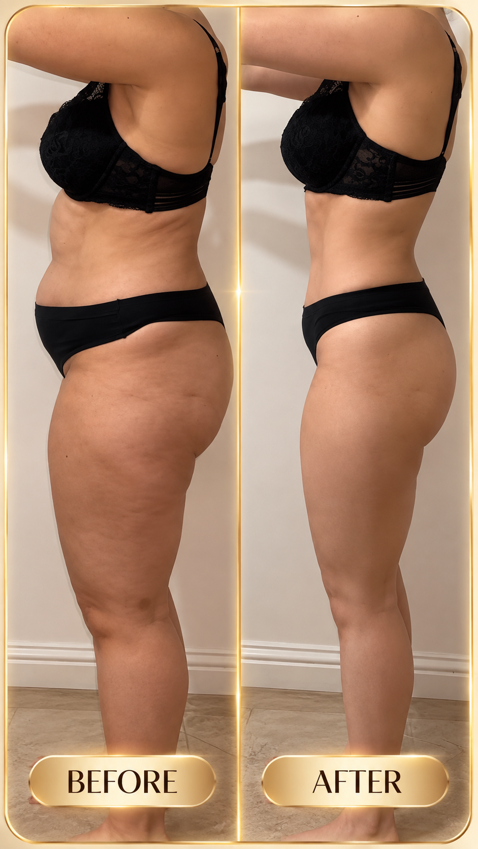 Real before and after result showing the waist and abdomen