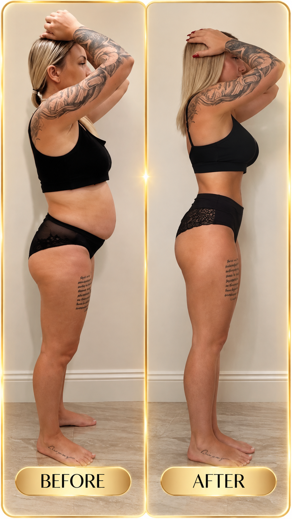 Real before and after result, profile view